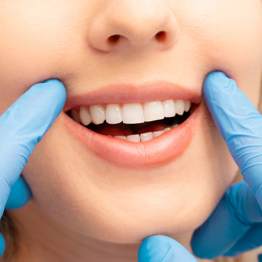 Read more about the article Smile makeover in Geelong